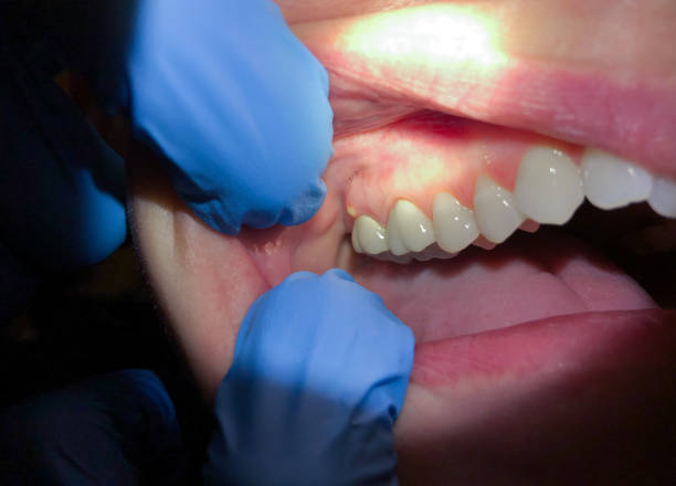 Best Pediatric Emergency Dentist in Oglethorpe, GA
